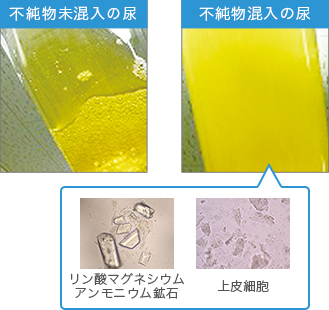 不純物未混入の尿 不純物混入の尿 リン酸マグネシウムアンモニウム鉱石 上皮細胞