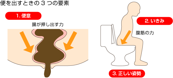 便を出すときの3つの要素 1.便意 腸が押し出す力 2.いきみ 腹筋の力 3.正しい姿勢