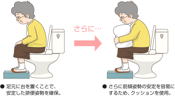 排便に適した姿勢の提供 生活習慣の改善による排便ケア 排便ケアの実践 排便ケア 排泄ケア 実践編 排泄ケアナビ ユニ チャーム