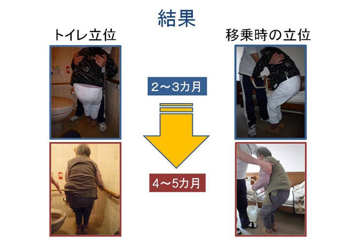 再びトイレでの排泄をめざして（2）｜排泄ケア研究発表｜コラム・研究発表 排泄ケアナビ ユニ・チャーム